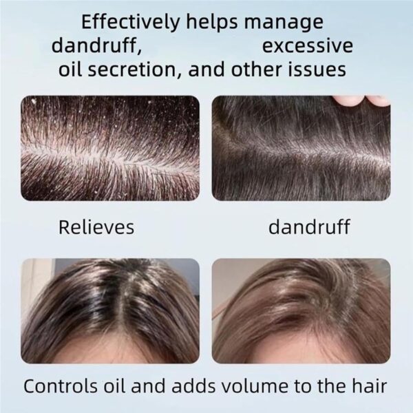 Nipori Shampoo,Hair Care Shampoo Oil Control Refreshing Cleansing for Men and Women (2Pcs) - Image 4