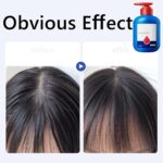 Nipori Shampoo,Hair Care Shampoo Oil Control Refreshing Cleansing for Men and Women (2Pcs) - Image 3