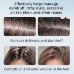 Nipori Shampoo, Selenium Hair Care Oil Control Refreshing Anti-Dandruff Cleansing, Antidandruff Shampoo for Men and Women, 300ML (1pcs) - Image 3