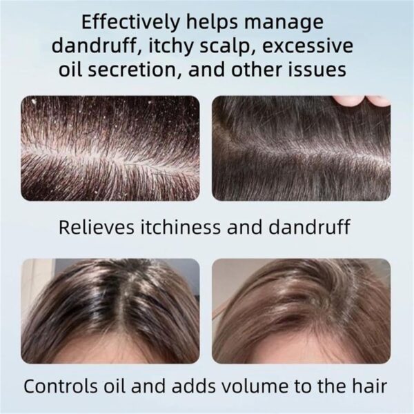 Nipori Shampoo, Selenium Hair Care Oil Control Refreshing Anti-Dandruff Cleansing, Antidandruff Shampoo for Men and Women, 300ML (1pcs) - Image 3