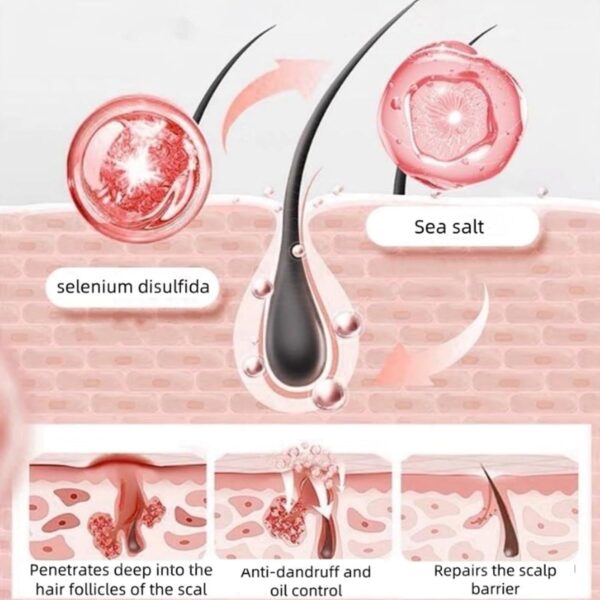 Nipori Shampoo, Selenium Hair Care Oil Control Refreshing Anti-Dandruff Cleansing, Antidandruff Shampoo for Men and Women, 300ML (1pcs) - Image 5