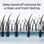 Nipori Shampoo, Selenium Hair Care Oil Control Refreshing Anti-Dandruff Cleansing, Antidandruff Shampoo for Men and Women, 300ML (1pcs) - Image 6