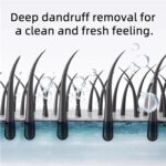 Nipori Shampoo - Hair Care Shampoo Oil Control Refreshing Anti-Dandruff Cleansing for Men and Women, 300ml (1) - Image 2