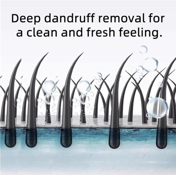 Nipori Shampoo - Hair Care Shampoo Oil Control Refreshing Anti-Dandruff Cleansing for Men and Women, 300ml (1) - Image 2